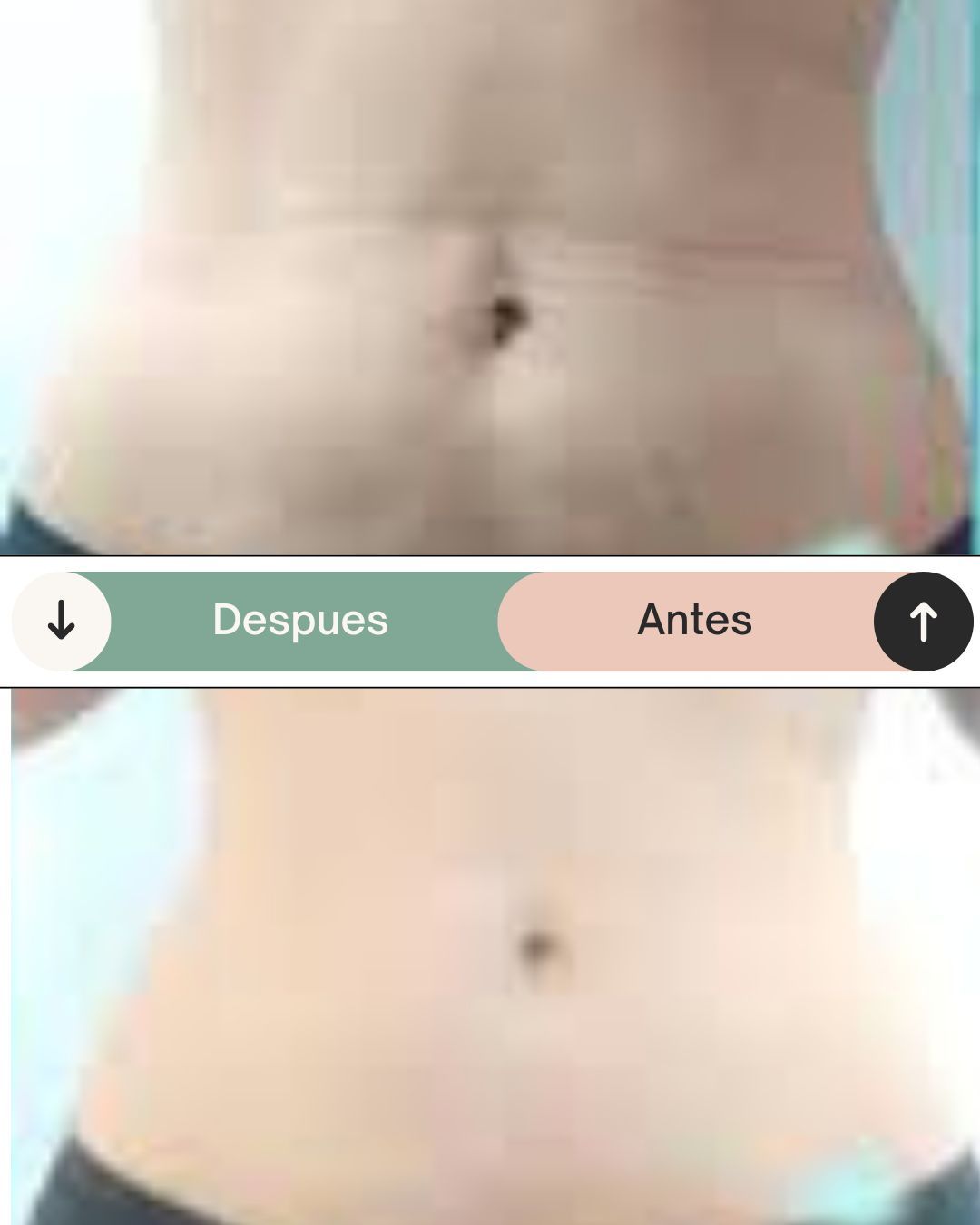 Liposonix 18 max